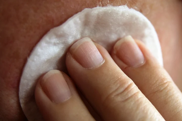 Toner in Modern Skincare: Do You Actually Need One?
